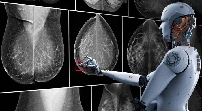 inteligenciaartificial_mamografia